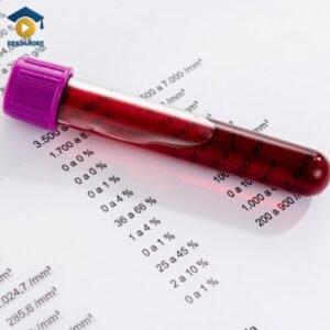 A close-up image of a blood sample in a purple-capped vial, lying on a medical lab report showing the results of a blood count test. This visual represents a key vocabulary term for healthcare professionals studying for the OET exam through online English courses on read4more.com.